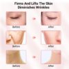 Radiofrequency Face Lifting Tighten Wrinkle Removal Face Massager - Image 6